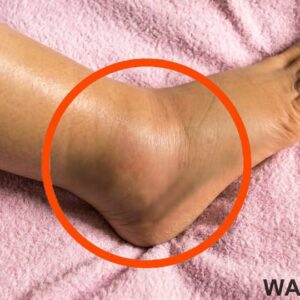 If you notice your legs are swollen, that’s a sign of ca…