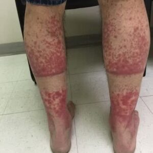 These are the consequences of sleeping with…