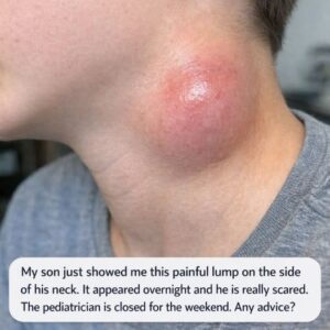 My son just showed me this painful lump on the side of his neck. It appeared overnight and he is really scared. The pediatrician is closed for the weekend. Any advice?