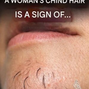 Why Chin Hair Grows in Women and What It May Indicate
