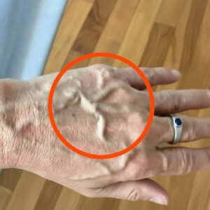 If you have visible veins it means you are…