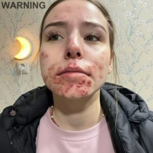 These are the consequences of sleeping with the…
