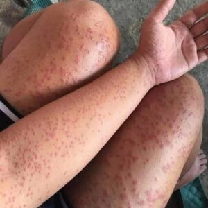 These are the consequences of sleeping with…