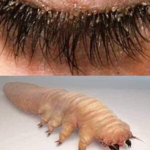 How To Spot Eyelash Mites