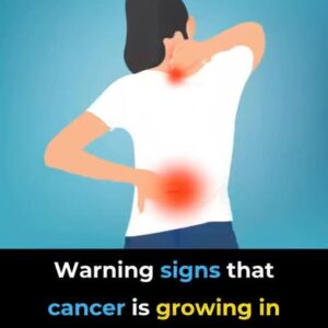 5 warning signs of cancer developing in the body