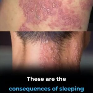 Genital Skin Changes: When to Worry and When to Relax