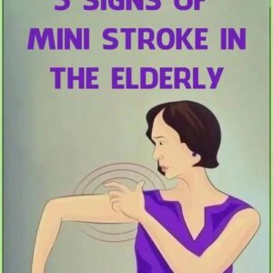 When Changes in Aging May Signal a Mini-Stroke: What to Look For