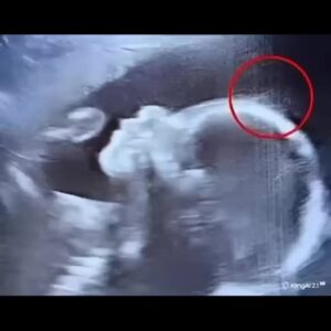 Doctors couldn’t believe what they saw during the ultrasound