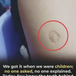 What the small round scar on your arm might indicate