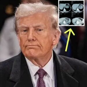 Internet On Edge After Trump Reveals The Results Of His MRI Scan