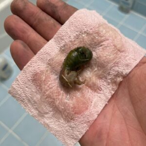 A Mysterious Discovery on Our Bathroom F