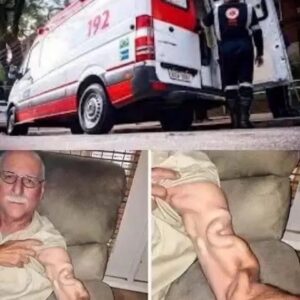 A SIMPLE STRETCH TURNED INTO A HORRIFYING MEDICAL NIGHTMARE THAT SHOCKED THE WORLD