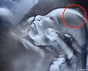 Doctors couldn’t believe what they saw during the ultrasound