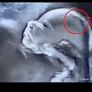 Doctors couldn’t believe what they saw during the ultrasound