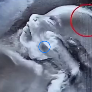 Doctors couldn’t believe what they saw during the ultrasound