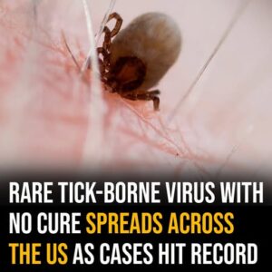 Rare tick-borne virus with no cure spreads across the US as cases hit record high – how to avoid it