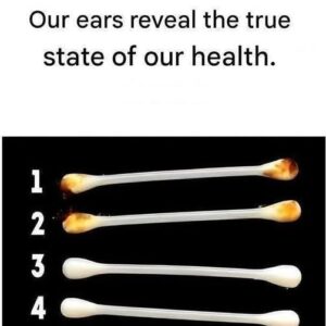 Our ears reveal our true state of health