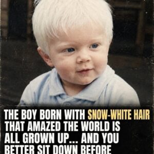 The Boy With Snow-White Hair Who Captivated the World – Where Is He Now?